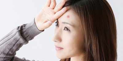おでこニキビの原因は大人と思春期とで少し異なる