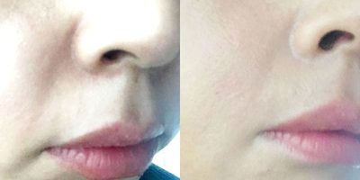 ほうれい線はメイクで隠せる! 目立たず自然にカバーする方法