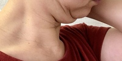 二重あごを解消したい!まずは原因を知ろう