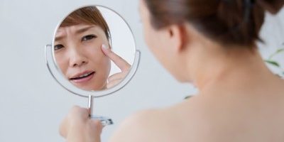 【要注意】にきびの悪化を防ぐために気を付けたい7つの事