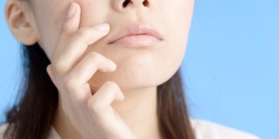 にきびに日焼け止めは塗って良い? ニキビ予防には紫外線ケアも大切