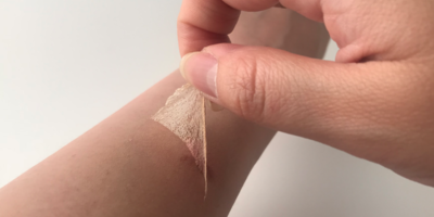 “メイク用ニキビカバーパッチ”をご存知ですか?美容意識の高い韓国人の定番ニキビケア