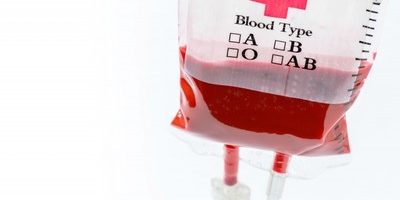 【愕然】血液クレンジングって美容に良いの? 海外論文など含め調査しました