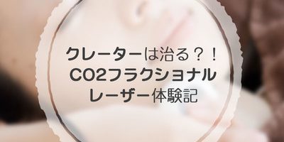 クレーターは治るのか?! CO2フラクショナルレーザー体験記!